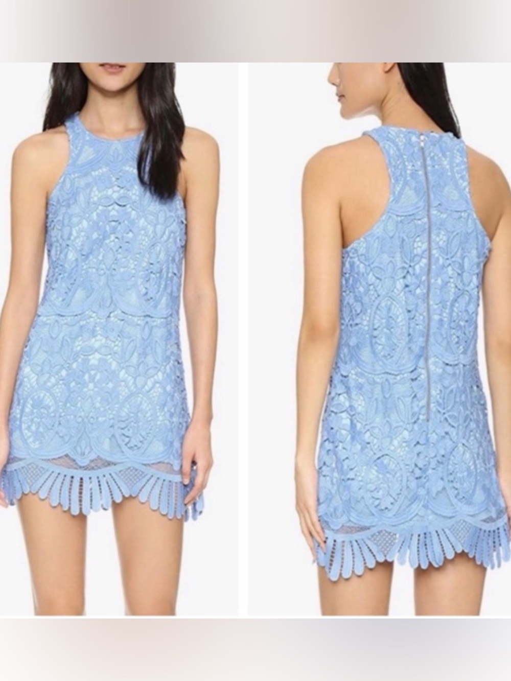 Lovers + Friends Blue Lace Mini Dress XS Scalloped Hem Sleeveless